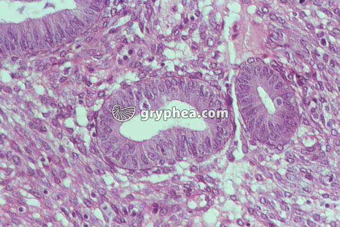 Endomètre prolifératif x100 - gryphea.com